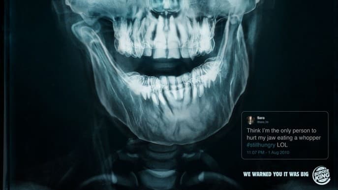 Burger King Brags About Causing Customers Pain with New X-Ray Ads