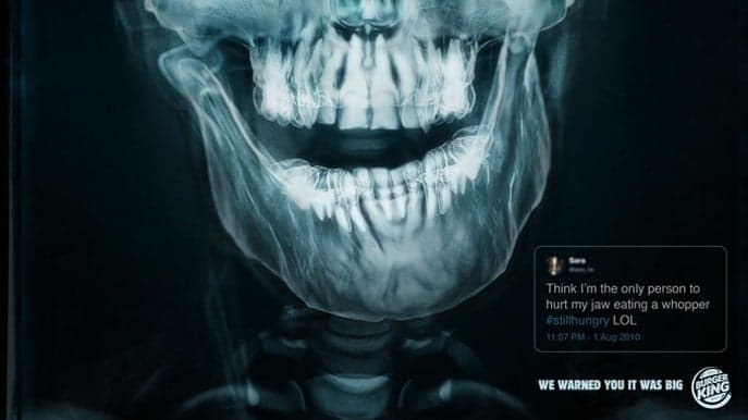 Burger King Brags About Causing Customers Pain with New X-Ray Ads Burger King Brags About Causing Customers Pain with New X-Ray Ads